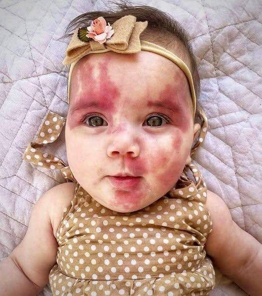 9. Baby called ‘hideous’ is a gorgeous grown-up little girl now